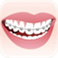 Orthodontic Alternatives